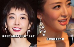 女星長期歪嘴遭酸「整壞」！親自認了動臉部手術　背後心酸原因曝光：嘴巴神經壞死